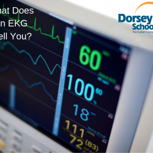 What Does an EKG Test For?