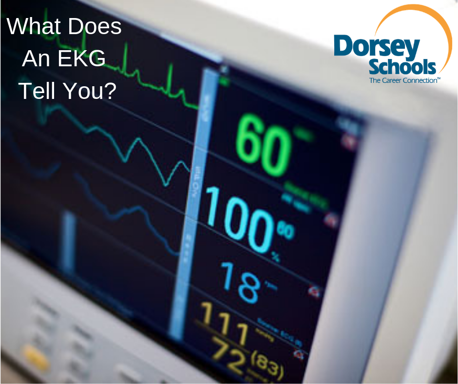 What Does an EKG Test For?