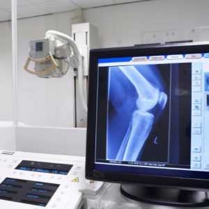 rad tech career path